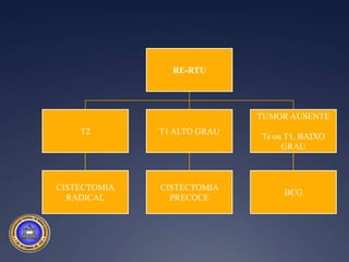 Quando podemos preservar a bexiga com mais segurança em T1 alto grau?Tu < 3 cmSolitárioAusência de CISRe-RTU: T0 / Ta