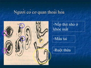 Người có cơ quan thoái hóa Ruột thừa Nếp thịt nhỏ ở  khóe mắt Mấu tai 