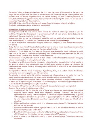 The patient's face is drawn with two lines: the first from the corner of the nostril to the top of the
tragus and the second from the corner of the mouth outside corner of the eye. In the junction point
we enter with the needle, perpendicular to the tissues, reaching the bone. Continue parallel to the
bone, both at the level zygomatic malar. We inject slowly withdrawing the needle. To end we rub to
homogenize the product on the periosteum.
Within 30-40 days, the fibrotic foreign body answer leads to increased volume treaty bone.
Treatment may be repeated up to aesthetic improvement.
Regeneration of the face adipose tissue
The regeneration of the face adipose tissue follows the outline of a technique already in use: the
lipofilling. This provides the removal of a certain amount of fat from a home device body and the
replanting of the same, treated or not, in the face.
Regeneration does not use the technique of normal fat cells but mainly of fat stem cells. These are
sown in small amounts to stimulate the formation of new adipose tissue (liposowing).
Fat is rich in stem cells. A stem cell is every 50 normal cells (compared to bone marrow that contains 1
for 10000).
Today there is much talk of the use of stem cells present in adipose tissue. Much to develop a machine
(high cost) that can increase and separate the stem cells of the fat.
Professor J. Victor Garcia and Prof. Maurizio Ceccarelli have developed a simple technique to enrich
stem cells in the area of collection for Liposowing. This technique has been presented for the first
time at BioBridge Event of 2008 in Geneva Palais des Nations.
The explanation of why the fat is so rich in stem cells be found in the need to accumulate energy by
adipose tissue in a state of adipocyte hypertrophy.
The adipocyte is able to significantly increase its volume to collect energy in the triglycerides form.
But when its volume is very high (greater than 170% of normal volume) the adipocyte stimulates the
formation of new adipose tissue by activating the differentiation of stem cells in the stroma-vascular
connective tissue.
The liposintetic stimulus leads to adipocyte hypertrophy that, at a certain volume, to stimulate
perivascular stem cell propagation and differentiation.
The stimulus to mitosis and differentiation preadipocytes follows mainly to increasing the rate for
insulin receptor down regulation in the hypertrophic adipocyte and the liberation IGF-1.
The insulin receptor down regulation creates insulin resistance. It follows to a local concentration gain
of insulin and to a preadipocytes stimulation. The volume adipocyte increase active paracrine secretion
of IGF-1 and stimulates the preadipocytes formation.
The liposowing differs therefore from lipofilling mainly because fat stem cells are implanted.
Based on the foregoing, the Liposowing provides:
1. Stimulation of the fat donation area of body with glucose and insulin increase the volume
adipocyte ready. Insulin, which main lipogenetic hormone, stimulates the function of
lipoproteinlipase allowing fatty acids uptake of circulating lipoprotein and the entry of glucose
in the adipocyte. Glucose is the precursor of glycerol phosphate. The latter binds fatty acids
to form triglycerides. It uses an amount corresponding to 1 IU of insulin per kilo of fat to
stimulate.
2. 100 units of insulin are diluted in 250 cc of saline solution or glucose 5%. The resultant solution
with 0.4 U.I. per milliliter.
3. We use a milliliter of this solution together with 200 ml of 5% glucose to stimulate an area of
fat removal of 400 cubic centimeters.
4. Inject 0.5 milliliters per cubic centimeter of fat on the prepared solution with a concentration
of 1 IU insulin per fat stimulate kilo and a concentration of 5% glucose.
5. After 4 hours of the first infiltration if it makes a second adding 1% local anesthetic and
adrenaline.
 