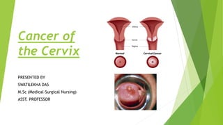 Cancer of
the Cervix
PRESENTED BY
SWATILEKHA DAS
M.Sc (Medical-Surgical Nursing)
ASST. PROFESSOR
 