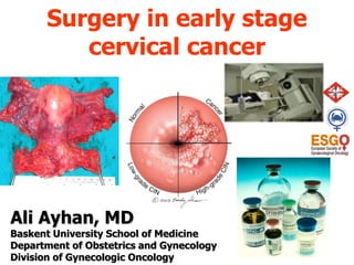 Surgery in early stage
cervical cancer
Ali Ayhan, MD
Baskent University School of Medicine
Department of Obstetrics and Gynecology
Division of Gynecologic Oncology
 