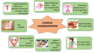 Vaginal bleeding
that occurs
between menstrual
periods or after
menopause
Leg
swelling
Vaginal discharge
that is thick,
odorous or tinged with
blood
Vaginal bleeding
during a pelvic examination
Vaginal
bleeding or
pain
during sexual
intercourse
Menstrual
periods that are
heavier or last longer than
usual
Painful urination
and
Urinary
urgency or frequency
Pain in the lower
back or pelvic region
CLINICAL
MANIFESTATIONS
 