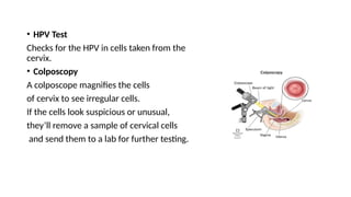 • HPV Test
Checks for the HPV in cells taken from the
cervix.
• Colposcopy
A colposcope magnifies the cells
of cervix to see irregular cells.
If the cells look suspicious or unusual,
they’ll remove a sample of cervical cells
and send them to a lab for further testing.
 