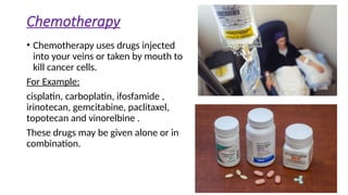 Chemotherapy
• Chemotherapy uses drugs injected
into your veins or taken by mouth to
kill cancer cells.
For Example:
cisplatin, carboplatin, ifosfamide ,
irinotecan, gemcitabine, paclitaxel,
topotecan and vinorelbine .
These drugs may be given alone or in
combination.
 