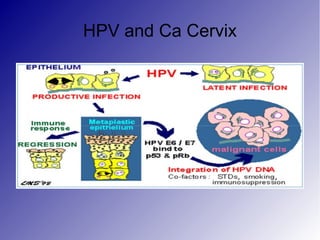 HPV and Ca Cervix
 