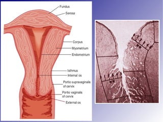 Ca cervix evaluation and staging