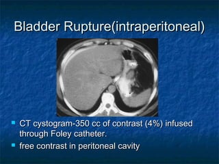 Foley Cystogram Cach doc-phim-chup-cat-lop-vi-tinh | PPT