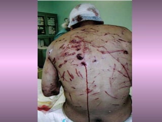 Cache cache dangereux