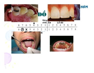 ; <=


⋅   #
        !
 