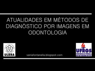 ATUALIDADES EM MÉTODOS DE DIAGNÓSTICO POR IMAGENS EM ODONTOLOGIA vaniafontanella.blogspot.com 