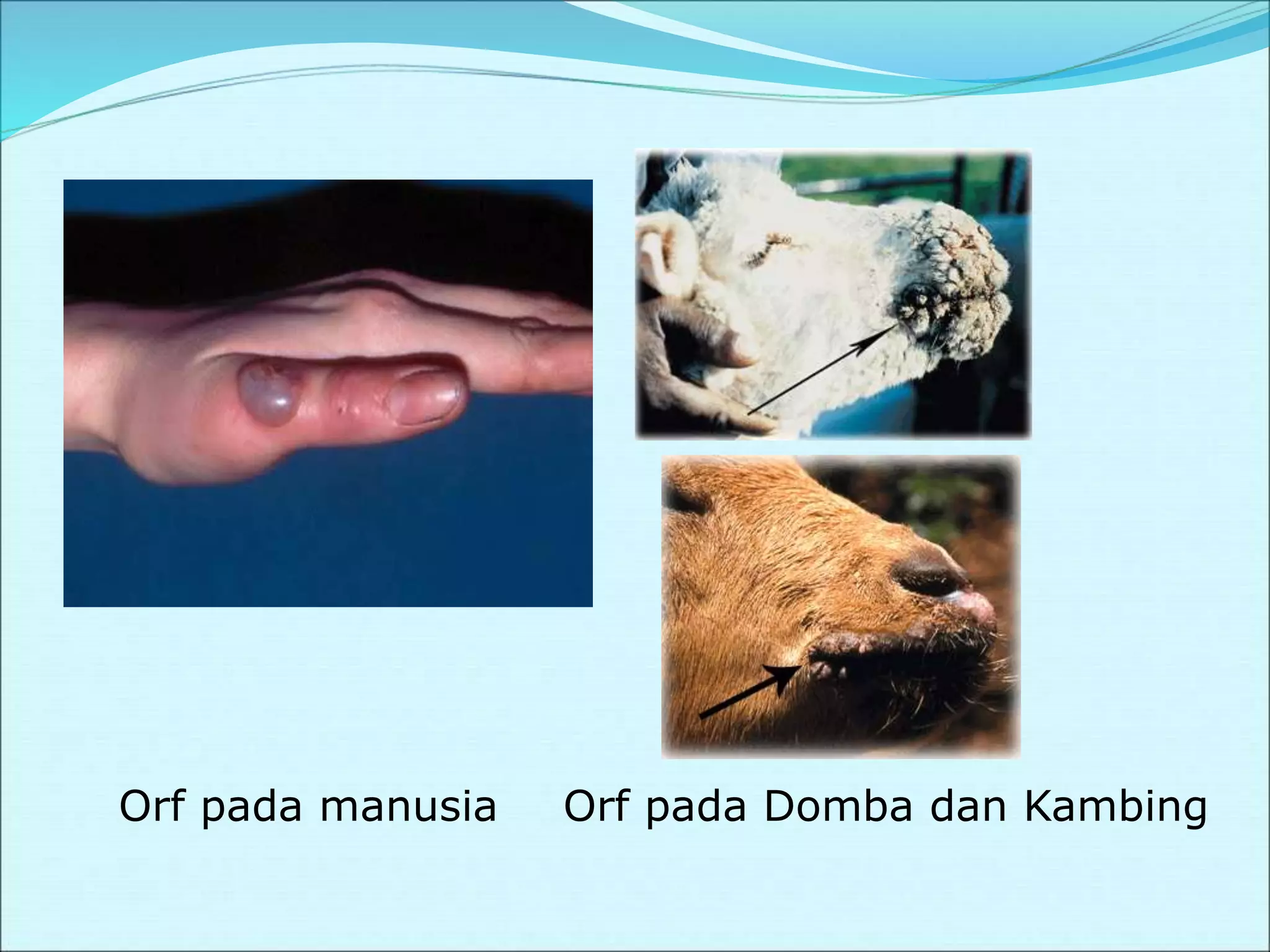 Orf pada manusia Orf pada Domba dan Kambing
 