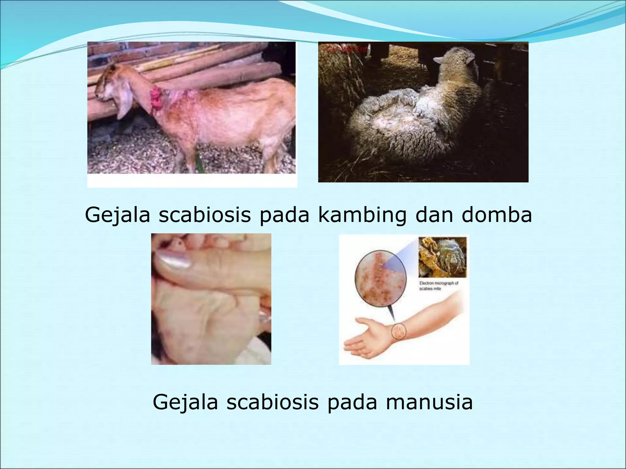Gejala scabiosis pada kambing dan domba
Gejala scabiosis pada manusia
 