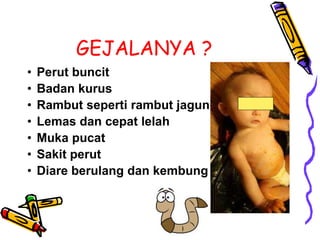 GEJALANYA ?
• Perut buncit
• Badan kurus
• Rambut seperti rambut jagung
• Lemas dan cepat lelah
• Muka pucat
• Sakit perut
• Diare berulang dan kembung
 