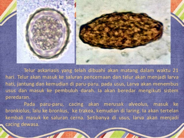 78 Gambar Telur Cacing Gelang Terlihat Keren 78 Gambar Telur Cacing Gelang Terlihat Keren