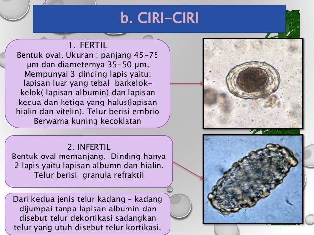 78 Gambar Telur Cacing Gelang Terlihat Keren 78 Gambar Telur Cacing Gelang Terlihat Keren