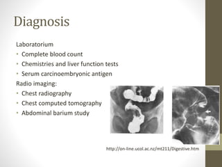 Diagnosis 
Laboratorium 
• Complete blood count 
• Chemistries and liver function tests 
• Serum carcinoembryonic antigen 
Radio imaging: 
• Chest radiography 
• Chest computed tomography 
• Abdominal barium study 
http://on-line.ucol.ac.nz/mt211/Digestive.htm 
 