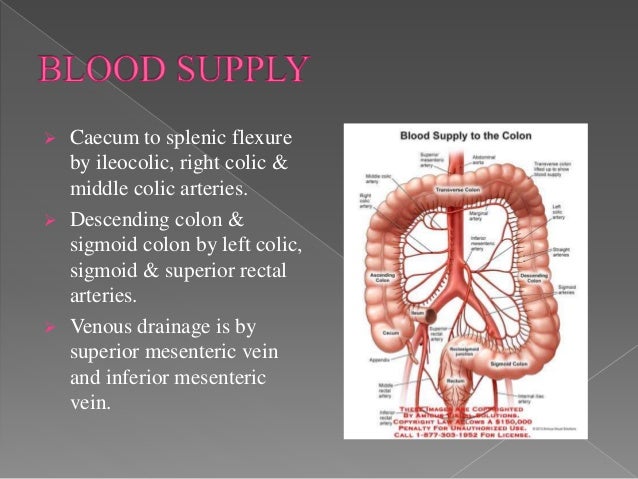 Carcinoma colon