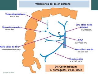 Dr. Edgar Yan Quiroz
Variaciones del colon derecho
TGC
Vena cólica derecha
Vena ileocólica
A la VMS 100%
A la VMS 56%
Vena cólica derecha
Al TGC 44%
Vena cólica media
principal
A la VMS 85%
Rama cólica del TGC
También llamada VCD acc.
Vena cólica media acc
Al TGC 40%
Con VGED 69%
 