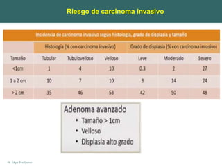 Dr. Edgar Yan Quiroz
Riesgo de carcinoma invasivo
 