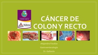 CÁNCER DE
COLONY RECTO
Alejandra Faudoa
Gastroenterología
Dr. Gallardo
 
