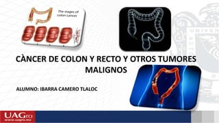 CÀNCER DE COLON Y RECTO Y OTROS TUMORES
MALIGNOS
ALUMNO: IBARRA CAMERO TLALOC
 
