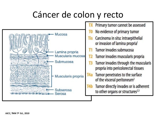 Como evitar cancer de colon