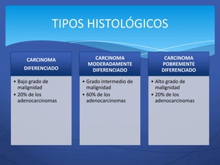 TIPOS HISTOLÓGICOS

     CARCINOMA          CARCINOMA                CARCINOMA
                      MODERADAMENTE             POBREMENTE
    DIFERENCIADO       DIFERENCIADO             DIFERENCIADO

• Bajo grado de     • Grado intermedio de   • Alto grado de
  malignidad          malignidad              malignidad
• 20% de los        • 60% de los            • 20% de los
  adenocarcinomas     adenocarcinomas         adenocarcinomas
 