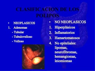 CLASIFICACION DE LOS
POLIPOS
 