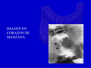 IMAGEN EN
CORAZON DE
MANZANA.
 