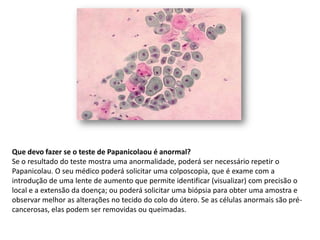 Que devo fazer se o teste de Papanicolaou é anormal?
Se o resultado do teste mostra uma anormalidade, poderá ser necessário repetir o
Papanicolau. O seu médico poderá solicitar uma colposcopia, que é exame com a
introdução de uma lente de aumento que permite identificar (visualizar) com precisão o
local e a extensão da doença; ou poderá solicitar uma biópsia para obter uma amostra e
observar melhor as alterações no tecido do colo do útero. Se as células anormais são pré-
cancerosas, elas podem ser removidas ou queimadas.
 