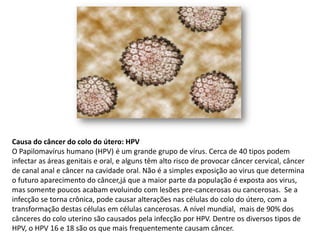 Causa do câncer do colo do útero: HPV
O Papilomavírus humano (HPV) é um grande grupo de vírus. Cerca de 40 tipos podem
infectar as áreas genitais e oral, e alguns têm alto risco de provocar câncer cervical, câncer
de canal anal e câncer na cavidade oral. Não é a simples exposição ao virus que determina
o futuro aparecimento do câncer,já que a maior parte da população é exposta aos virus,
mas somente poucos acabam evoluindo com lesões pre-cancerosas ou cancerosas. Se a
infecção se torna crônica, pode causar alterações nas células do colo do útero, com a
transformação destas células em células cancerosas. A nível mundial, mais de 90% dos
cânceres do colo uterino são causados ​pela infecção por HPV. Dentre os diversos tipos de
HPV, o HPV 16 e 18 são os que mais frequentemente causam câncer.
 