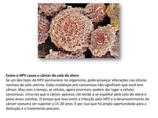 Como o HPV causa o câncer do colo do útero
Se um dos tipos do HPV permanece no organismo, pode provocar alterações nas células
normais do colo uterino. Estas mudanças pré-cancerosas não significam que você tem
câncer. Mas com o tempo, as células, agora anormais, podem dar lugar a células
cancerosas. Uma vez que o câncer aparece, ele tende a se espalhar pelo colo do útero e
pelas áreas vizinhas. O tempo que leva entre a infecção pelo HPV e o desenvolvimento do
câncer costuma ser superior a 15-20 anos. É por isso que há ampla oportunidade para a
detecção e o tratamento precoce.
 