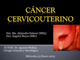 Dra. Ma. Alejandra Salazar (MR3)
  Dra. Ángeles Reyes (MR1)



TUTOR: Dr. Ignacio Molina
Cirugía General y Oncológica

                 Miércoles 23 Enero 2013
 
