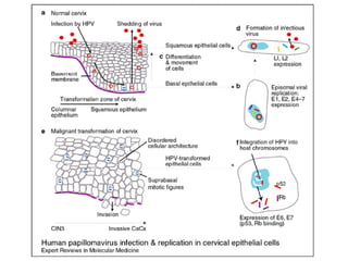 Cáncer cervicouterino. Patología Especial.