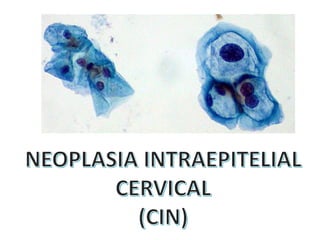 Cáncer cervicouterino. Patología Especial.