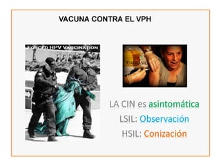 Cáncer cervicouterino. Patología Especial.