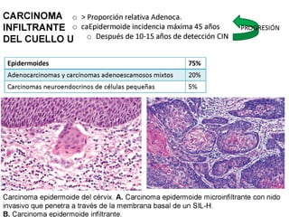 Cáncer cervicouterino. Patología Especial.