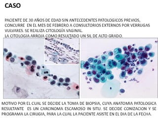 Cáncer cervicouterino. Patología Especial.