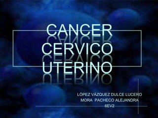CANCER
CERVICO
UTERINO
LÓPEZ VÁZQUEZ DULCE LUCERO
MORA PACHECO ALEJANDRA
6EV2
 