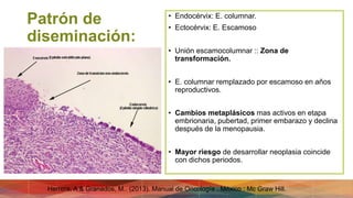 Patrón de
diseminación:
• Endocérvix: E. columnar.
• Ectocérvix: E. Escamoso
• Unión escamocolumnar :: Zona de
transformación.
• E. columnar remplazado por escamoso en años
reproductivos.
• Cambios metaplásicos mas activos en etapa
embrionaria, pubertad, primer embarazo y declina
después de la menopausia.
• Mayor riesgo de desarrollar neoplasia coincide
con dichos periodos.
Herrera, A & Granados, M.. (2013). Manual de Oncología . México : Mc Graw Hill.
 