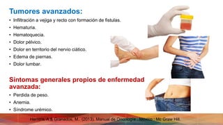 Tumores avanzados:
• Infiltración a vejiga y recto con formación de fistulas.
• Hematuria.
• Hematoquecia.
• Dolor pélvico.
• Dolor en territorio del nervio ciático.
• Edema de piernas.
• Dolor lumbar.
Síntomas generales propios de enfermedad
avanzada:
• Perdida de peso.
• Anemia.
• Síndrome urémico.
Herrera, A & Granados, M.. (2013). Manual de Oncología . México : Mc Graw Hill.
 