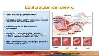 Exploración del cérvix.
• Casos iniciales: palparse indurado.
• Avanzados: palpar lesión voluminosa , irregular
y fácilmente sangrante (exofítica).
• Postmenopáusicas: lesión en canal
endocervical.
• Inspección con espejo vaginal:: normal,
pequeña ulcera indurada hasta lesión clásica
exofítica o endofítica (cérvix en barril).
• Debe examinarse vagina, vulva y piel perianal ::
segundo tumor primario.
Herrera, A & Granados, M.. (2013). Manual de Oncología . México : Mc Graw Hill.
 