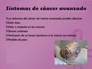 Síntomas de cáncer avanzado
Los síntomas del cáncer de mama avanzado pueden abarcar:
Dolor óseo
Dolor o molestia en las mamas
Úlceras cutáneas
Hinchazón de un brazo (próximo a la mama con cáncer)
Pérdida de peso
 
