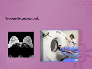 Tomografía computarizada
 