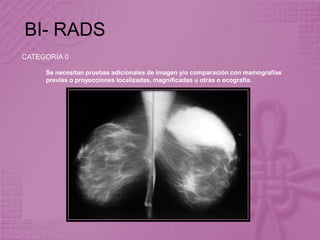 BI- RADS
CATEGORÍA 0
Se necesitan pruebas adicionales de imagen y/o comparación con mamografías
previas o proyecciones localizadas, magnificadas u otras o ecografía.
 
