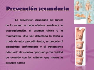 Prevención secundaria
La prevención secundaria del cáncer
de la mama se debe efectuar mediante la
autoexploración, el examen clínico y la
mastografía. Una vez detectada la lesión a
través de estos procedimientos, se procede al
diagnóstico confirmatorio y al tratamiento
adecuado de manera oportuna y con calidad
de acuerdo con los criterios que marca la
presente norma
 