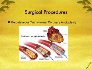 Surgical Procedures <ul><li>Percutaneous Transluminal Coronary Angioplasty </li></ul>