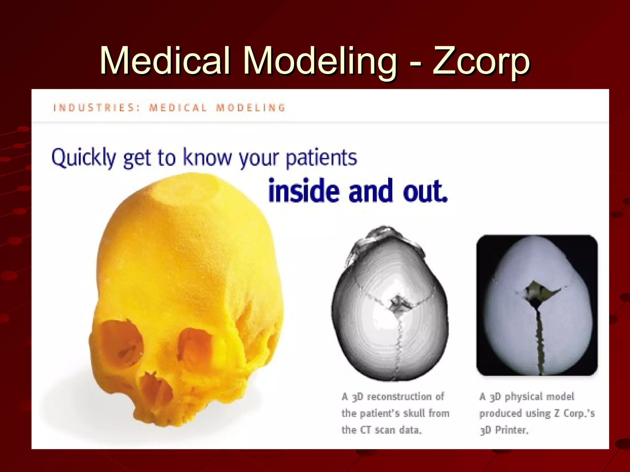Medical Modeling - Zcorp

 