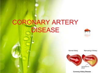 CORONARY ARTERY
DISEASE
 