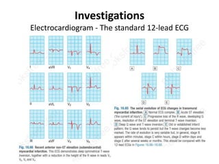 Investigations
Electrocardiogram - The standard 12-lead ECG
 